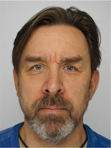 Estonia - Üllar Salumäe Estonia - Üllar Salumäe